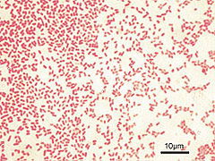 Bactérias Pseudomonas Aeruginosa